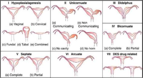 Role Of Three Dimensional Transvaginal Sonography Compared With