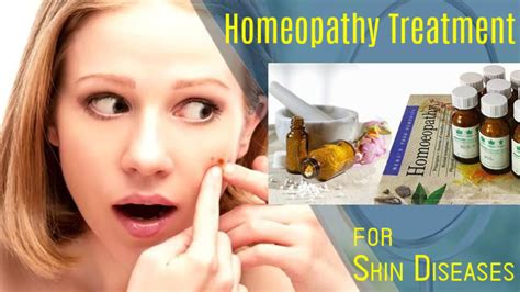 Homeopathy Treatment For Skin Diseases Rashes Allergies Etc