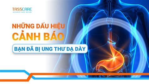 Những dấu hiệu cảnh báo bạn đã bị ung thư dạ dày | Trung tâm xét nghiệm