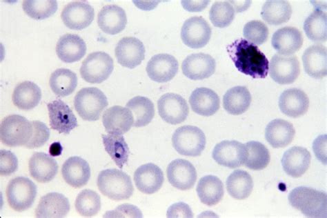 Kostenlose Bild Mikroskopische Aufnahme Plasmodium Falciparum Microgametocyte