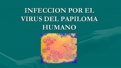 Virus Del Papiloma Humano La Infecci N Por Virus Papiloma Humano Vph
