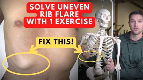 how to fix uneven rib flare with 1 exercise you ve never tried this before youtube
