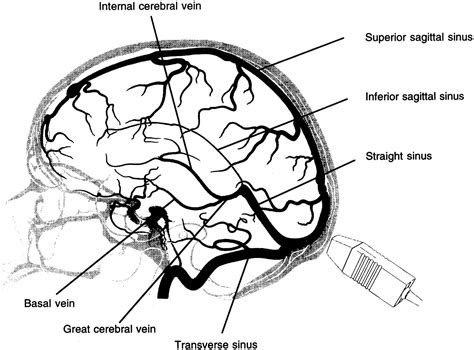 Great Cerebral Vein