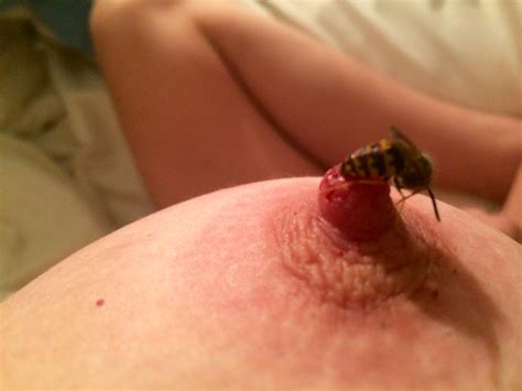 Wasps Sting Clitoris Nude Pics Comments