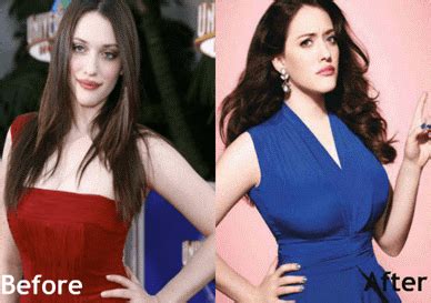 Kat Dennings Plastic Surgery Body Measurements Before And After Pics