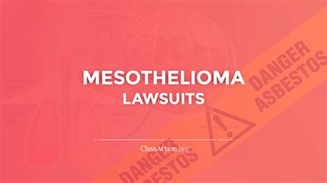 For example, state law may allow an attorney to charge a 30% contingency fee on the first $250,000 of a claim, 40% of the next $200,000 of the same claim, and 50% of the next $200,000 of the same claim. Mesothelioma Lawsuits | Asbestos Cancer | ClassAction.org