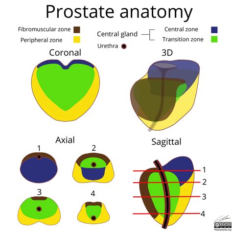 Prostate Gland Anatomy Mri