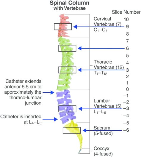 Maybe you would like to learn more about one of these? Localization of catheter opening and spinal cord slice ...