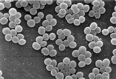 其中常见的种类包括:藻状菌纲的柱孢犁头霉(absidia cylindrospora)、冻土毛霉(mucor hiemalis),大毛霉(mucor mucedo),美丽 枝 霉 (thamnidium elegans),卵 孢 接 霉(zygorynchus moelleri);子囊菌纲的构巢曲霉(aspergillus nidulans. 56张图片带你看看细菌到底长啥样？_葡萄球菌