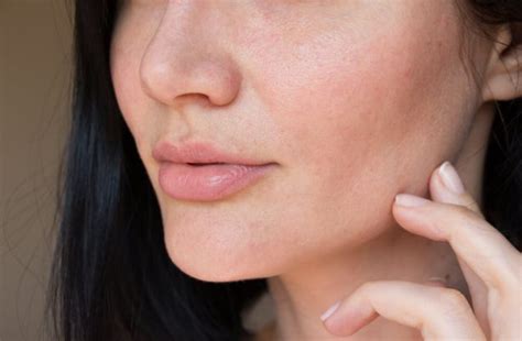 6 Gestes Efficaces Pour Se Débarrasser Des Pores Dilatés Vie Féminine