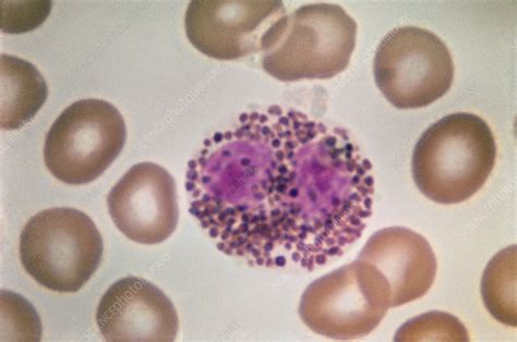 Eosinophil Lm Stock Image C0222163 Science Photo Library