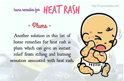 25 Home Remedies For Heat Rash On Face Neck Arms And Legs