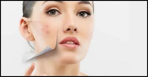 Surprising Reasons For An Acne Breakout Dr Farrah Md