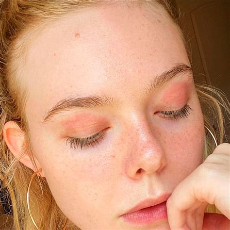 Elle Fanning Revela Su Eczema Sin Maquillaje Foto 4