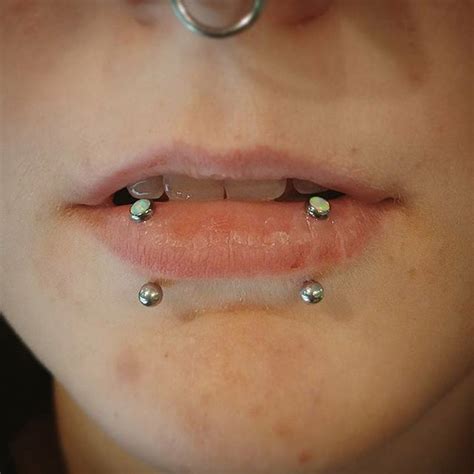 I Recently Downsized Some Awesome Double Vertical Labret Piercings That
