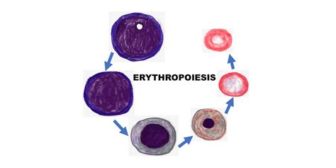 Erythropoiesis Pathology Made Simple