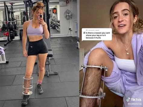 Millie Mclay Leg Woman Hits Back At Trolls Who Mocked Her For Hairy
