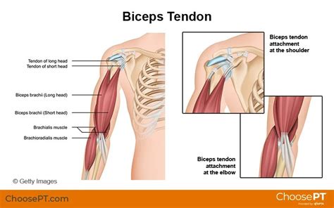 Guide Physical Therapy Guide To Biceps Tendon Rupture