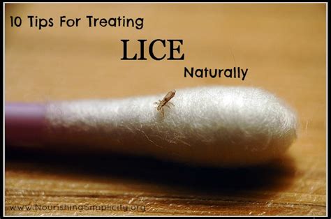 10 Tips To Get Rid Of Lice Naturally - Nourishing Simplicity