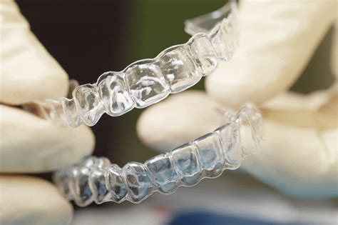 removable vs permanent retainers which is right for you