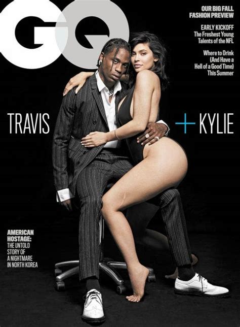 Travis Scott And Kylie Jenner Nude Gq Photo Shows Off Jenners Leg Scar — Heres How She Got It