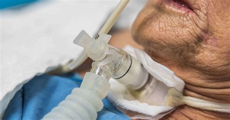 Advanced Airway Techniques Help Patients Breathe Easier