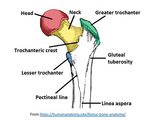 What Is A Proximal Femoral Fracture With Pictures Images And Photos