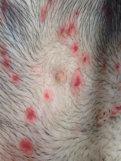 Doberman Forum Doberman Breed Dog Forums Bites Ringworm Or