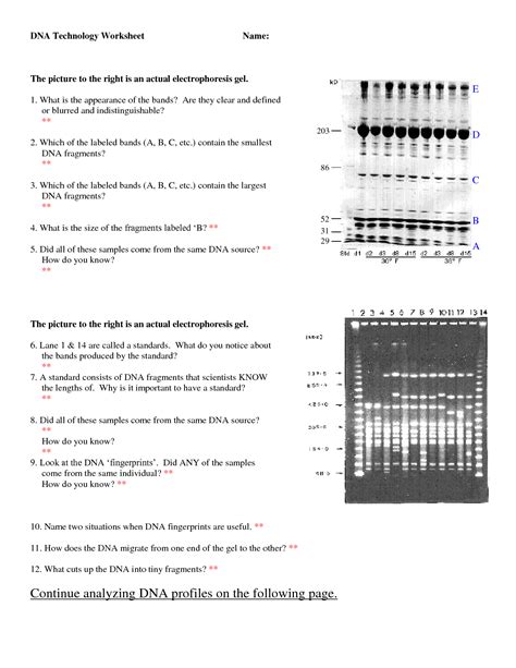 Firstly, i'd like to mention its reciprocal names; 10 Best Images of DNA Fingerprinting Biology Worksheet ...