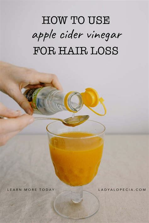 Apple Cider Vinegar For Hair Loss Does It Work My 2020 Review Lady