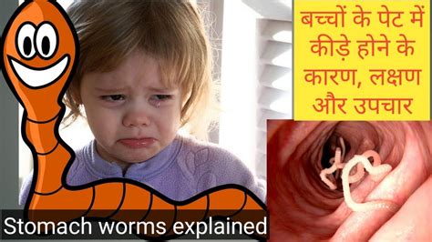 बच्चों के पेट में कीड़े होने के कारण लक्षण और उपचार Stomach Worms