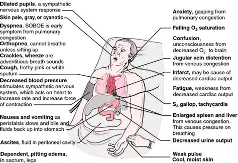 Signs Of End Stage Congestive Heart Failure