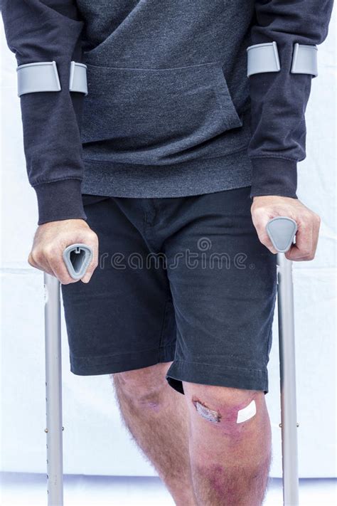 Man On Crutches Stock Image Image Of Lean Walking Hurt 44965331