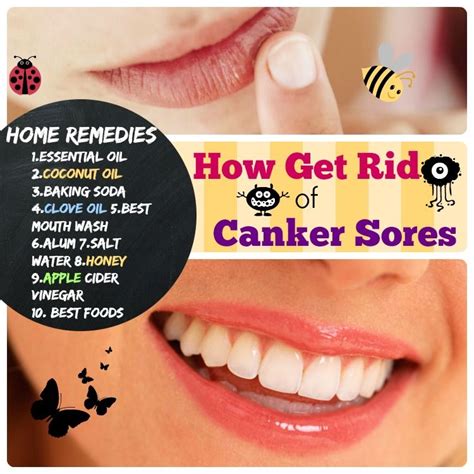 How To Get Rid Of Canker Sores 1essential Oil 2coconut Oil 3baking