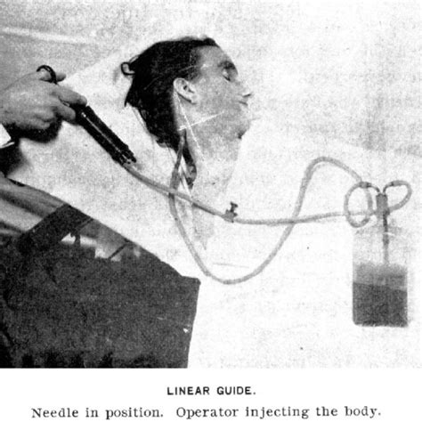 Embalmer Injecting The Corpse With Fluid Courtesy Of The National