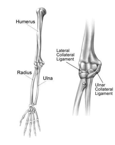 Anatomical structures and specific regions are visible as dynamic labeled images. Chronic Elbow Instability - Recurrent Dislocation ...