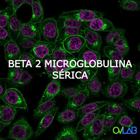 Beta 2 Microglobulina SÉrica Ovlab Oandv Laboratorios
