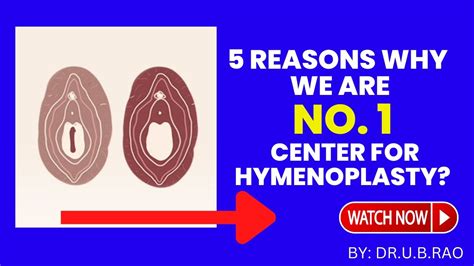 hymen repair 5 things to know before surgery youtube