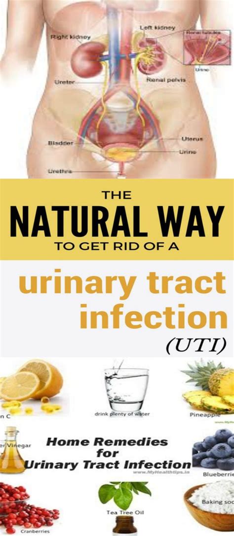 Doctors typically treat urinary tract infections with antibiotics. The Natural Way to Get Rid of a Urinary Tract Infection ...