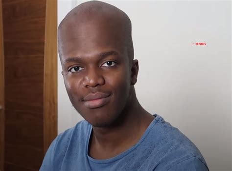 Ksi Forehead Ksi Reveals Forehead Ksi Thought Id Try Another