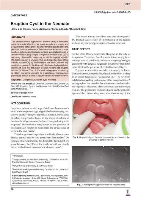 Pdf Eruption Cyst In The Neonate