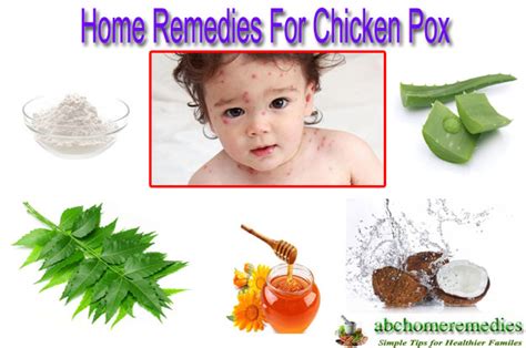 12 Tremendous Home Remedies For Chicken Pox Abchomeremedies