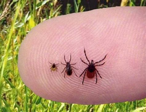 A New Tick Borne Parasite That Invades Red Blood Cells Beware Babesiosis