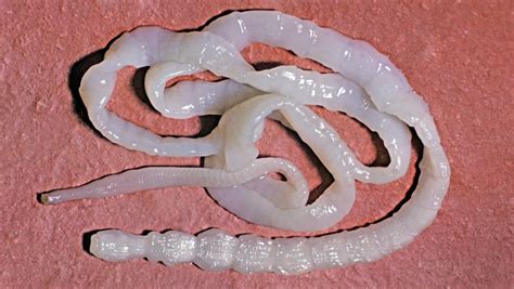 Parasite Expert Tells Shocking Story Of Human Tapeworm Abc Adelaide