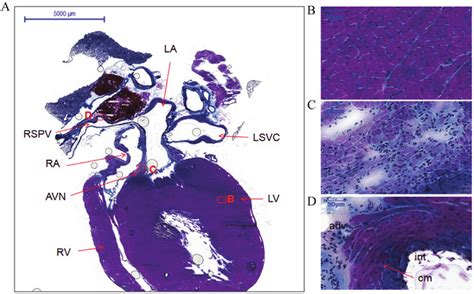 Histology Of The Atria Ventricles Atrioventricular Node And Right