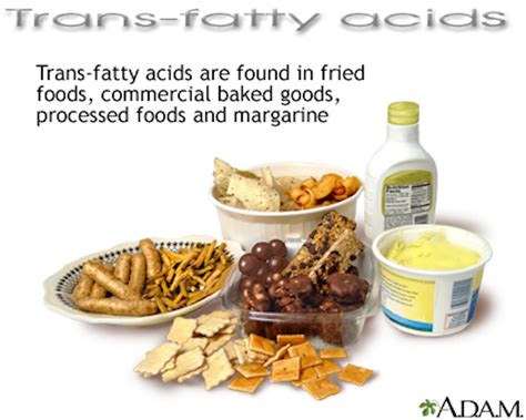 Nutrition And A Child With Ds Part 3