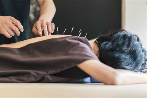 Read up on these interesting facts about acupuncture