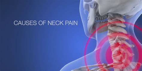 Ways To Conquer Chronic Neck Pain