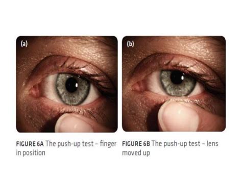 Fitting Assessment Of Various Contact Lenses