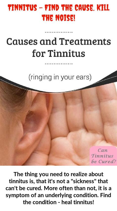 Among The First Steps Toward Finding Tinnitus Cures Would Be To